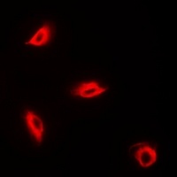 Perforin 1 Rabbit Polyclonal Antibody