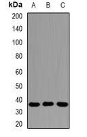 AMPK beta 2 Rabbit Polyclonal Antibody