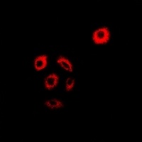 AMPK beta 2 Rabbit Polyclonal Antibody