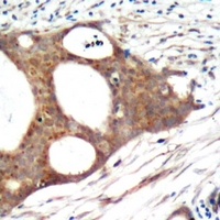 PRMT5 Rabbit Polyclonal Antibody