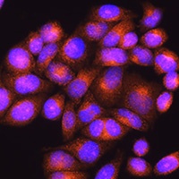 Presenilin 2 Rabbit Polyclonal Antibody