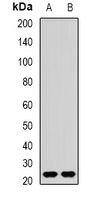 REEP1 Rabbit Polyclonal Antibody