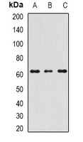 RIPK2 Rabbit Polyclonal Antibody