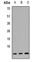 S100-A12 Rabbit Polyclonal Antibody