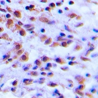S100-A12 Rabbit Polyclonal Antibody