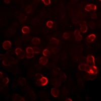 S100-A12 Rabbit Polyclonal Antibody