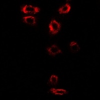 Syntenin Rabbit Polyclonal Antibody