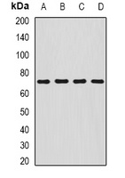 SDHA Rabbit Polyclonal Antibody
