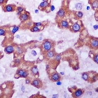 SDHA Rabbit Polyclonal Antibody