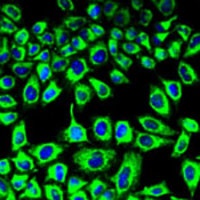 SDHA Rabbit Polyclonal Antibody