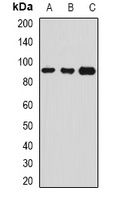 Serpin G1 Rabbit Polyclonal Antibody