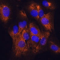 Serpin G1 Rabbit Polyclonal Antibody