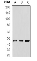 HSP47 Rabbit Polyclonal Antibody