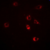 HSP47 Rabbit Polyclonal Antibody