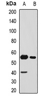 SFRP4 Rabbit Polyclonal Antibody