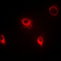 SFRP4 Rabbit Polyclonal Antibody