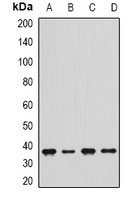 delta-Sarcoglycan Rabbit Polyclonal Antibody