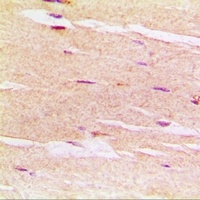 delta-Sarcoglycan Rabbit Polyclonal Antibody