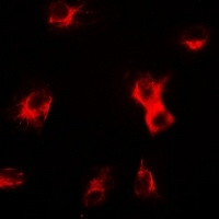 delta-Sarcoglycan Rabbit Polyclonal Antibody