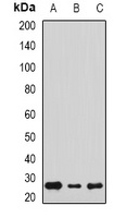 Sigma1 Receptor Rabbit Polyclonal Antibody