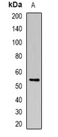 MCT4 Rabbit Polyclonal Antibody