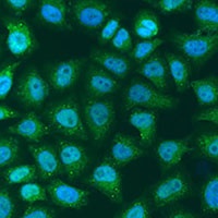 SOCS4 Rabbit Polyclonal Antibody