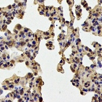 SOD2 Rabbit Polyclonal Antibody