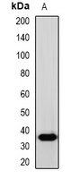 SOX2 Rabbit Polyclonal Antibody