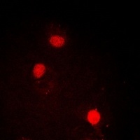 SOX2 Rabbit Polyclonal Antibody