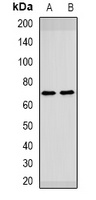 HAI-1 Rabbit Polyclonal Antibody