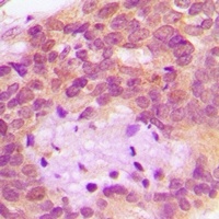 HAI-1 Rabbit Polyclonal Antibody