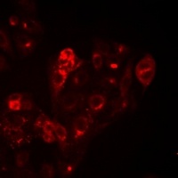 HAI-1 Rabbit Polyclonal Antibody