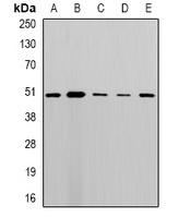 MLN64 Rabbit Polyclonal Antibody