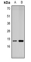 SUMO4 Rabbit Polyclonal Antibody