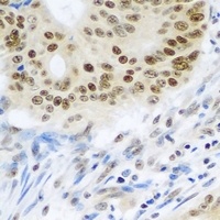 SUMO4 Rabbit Polyclonal Antibody