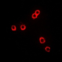 CD281 Rabbit Polyclonal Antibody