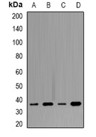 Tropomyosin Rabbit Polyclonal Antibody
