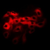 Tropomyosin Rabbit Polyclonal Antibody