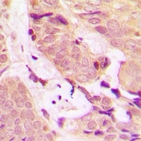TRAF2 Rabbit Polyclonal Antibody