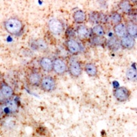 HSP75 Rabbit Polyclonal Antibody