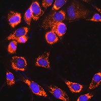 TRIM23 Rabbit Polyclonal Antibody