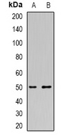 Thymidine Phosphorylase Rabbit Polyclonal Antibody