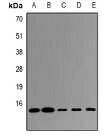 UBE2D4 Rabbit Polyclonal Antibody