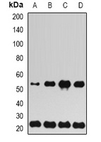 UBE2H Rabbit Polyclonal Antibody