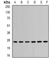 CDC34B Rabbit Polyclonal Antibody