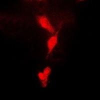 CDC34B Rabbit Polyclonal Antibody