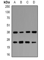 UBE2Z Rabbit Polyclonal Antibody