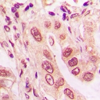 UBE2Z Rabbit Polyclonal Antibody