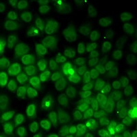 UFD1L Rabbit Polyclonal Antibody