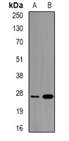 ULBP2 Rabbit Polyclonal Antibody